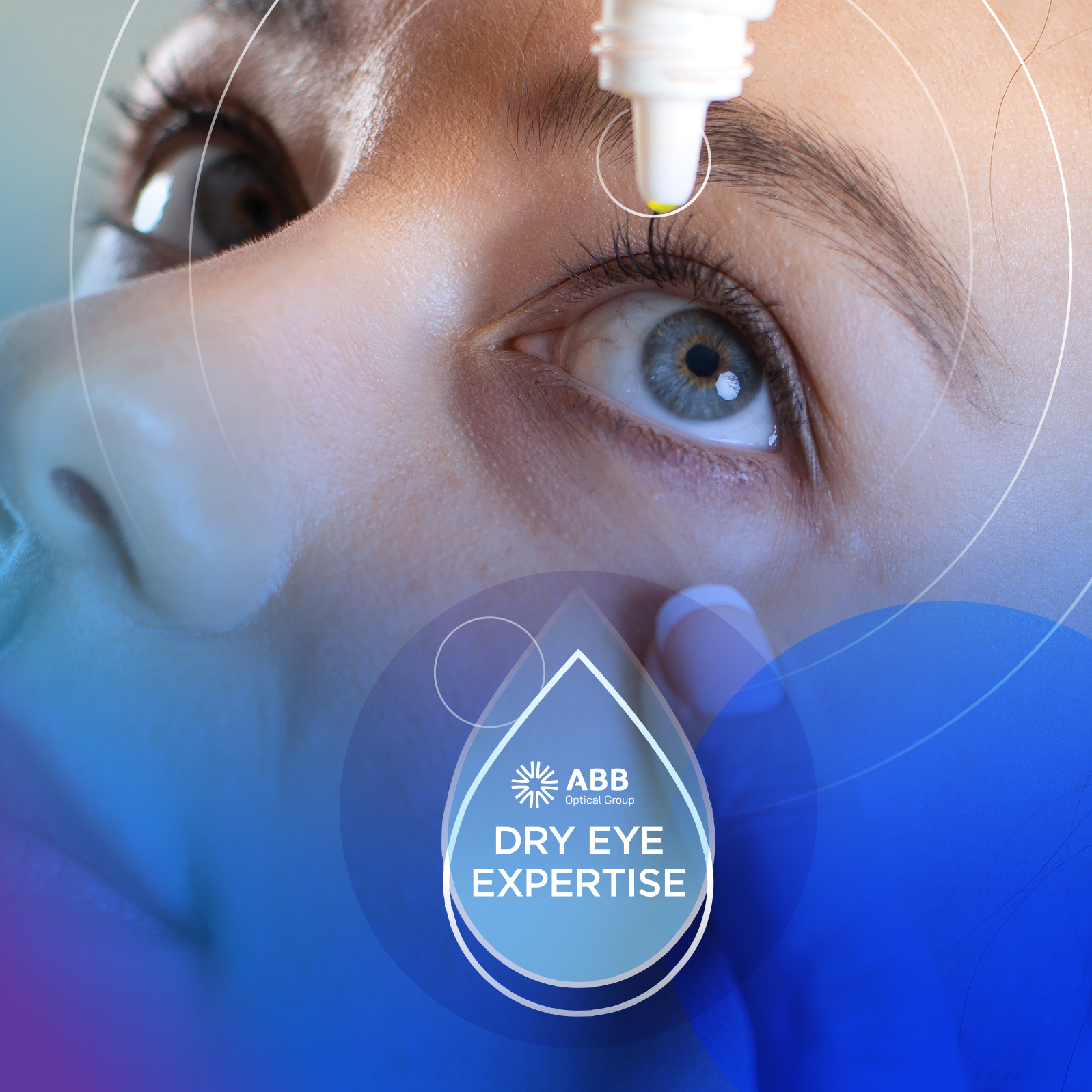 Dry Eye Care That Grows Your Practice